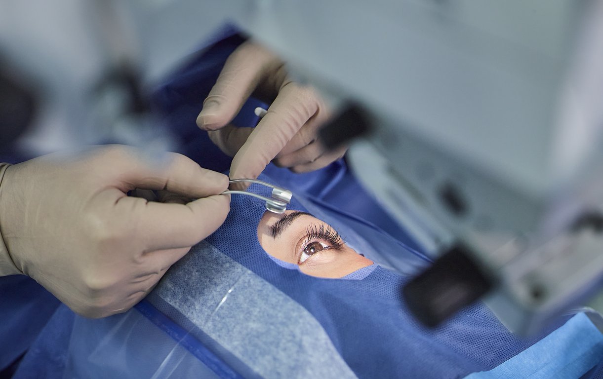 Nahaufnahme einer Patientin während einer Augenoperation; ein Chirurg in sterilen Handschuhen setzt vorsichtig eine Lidklemme (Lidsperrer) am Auge an.